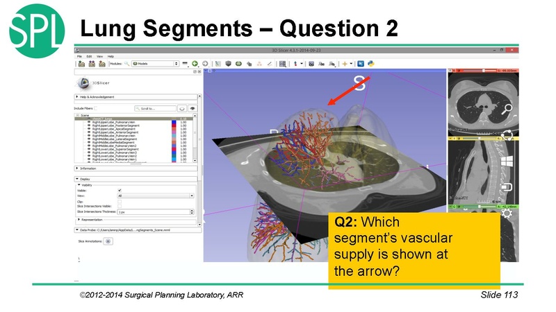 File:3DVisualizationDICOM SoniaPujol.pdf