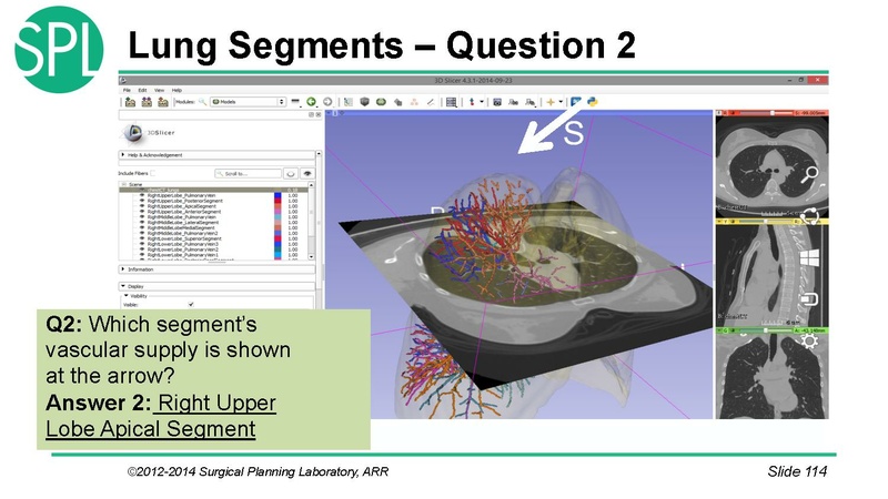 File:3DVisualizationDICOM SoniaPujol.pdf