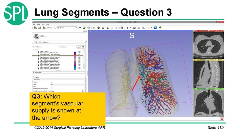 File:3DVisualizationDICOM SoniaPujol.pdf