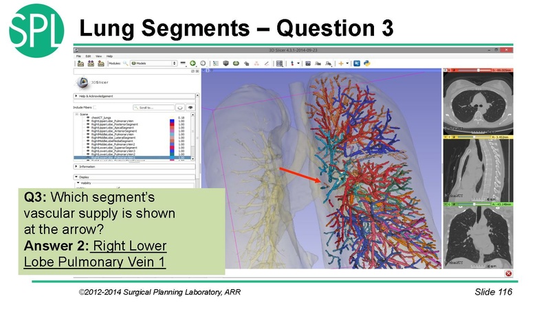 File:3DVisualizationDICOM SoniaPujol.pdf