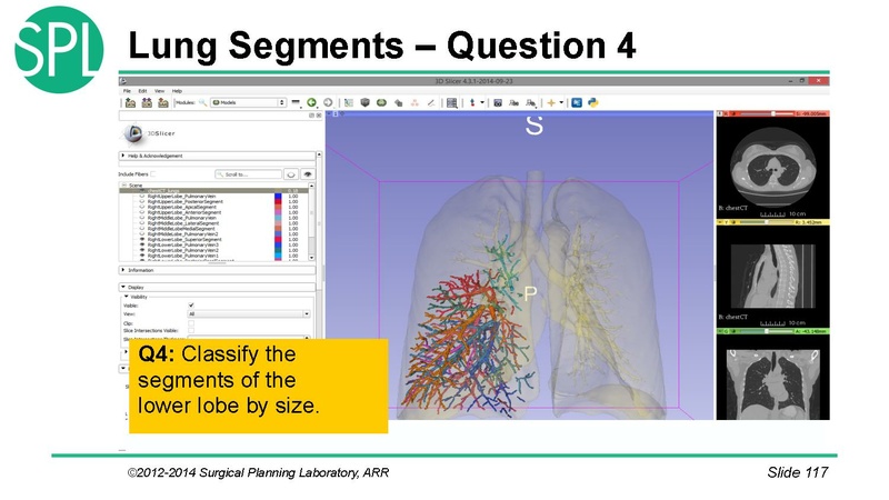 File:3DVisualizationDICOM SoniaPujol.pdf