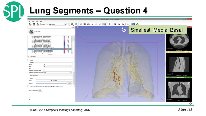 File:3DVisualizationDICOM SoniaPujol.pdf