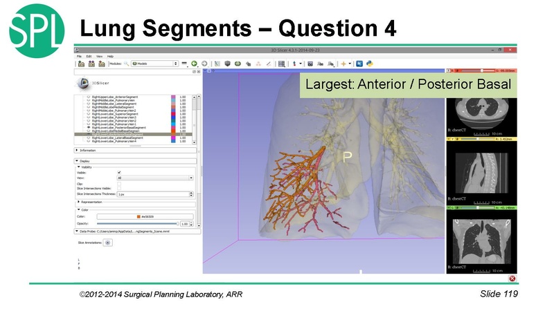 File:3DVisualizationDICOM SoniaPujol.pdf
