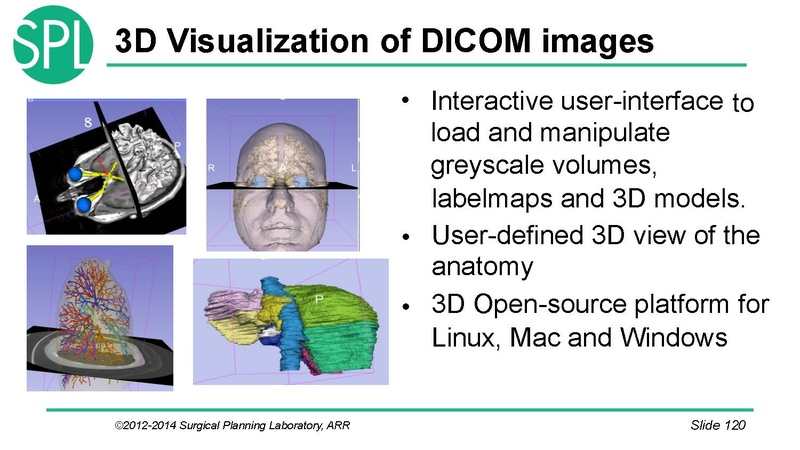 File:3DVisualizationDICOM SoniaPujol.pdf
