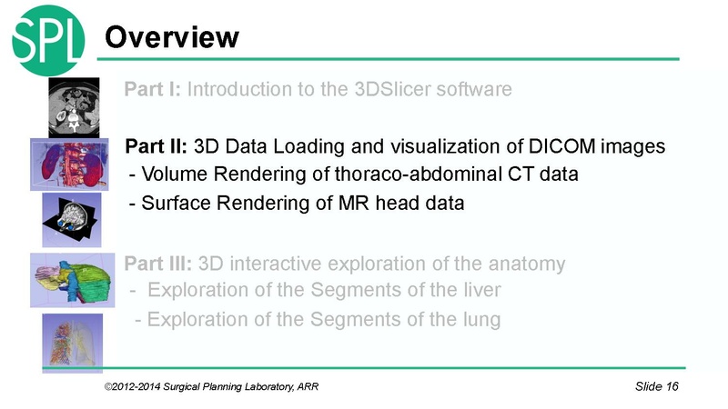 File:3DVisualizationDICOM SoniaPujol.pdf