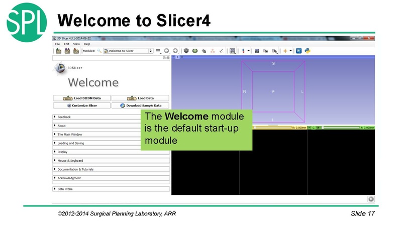 File:3DVisualizationDICOM SoniaPujol.pdf