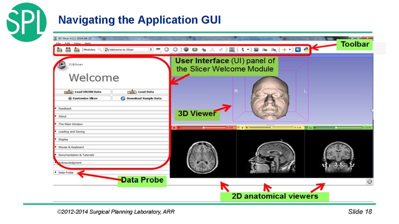 File:3DVisualizationDICOM SoniaPujol.pdf