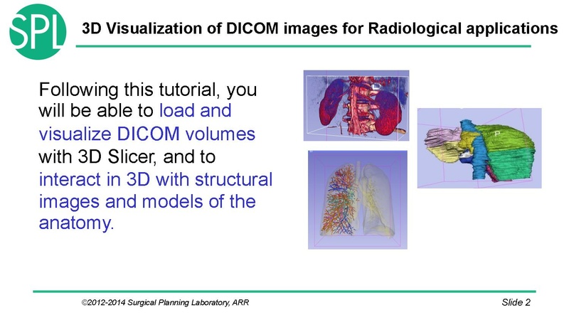 File:3DVisualizationDICOM SoniaPujol.pdf
