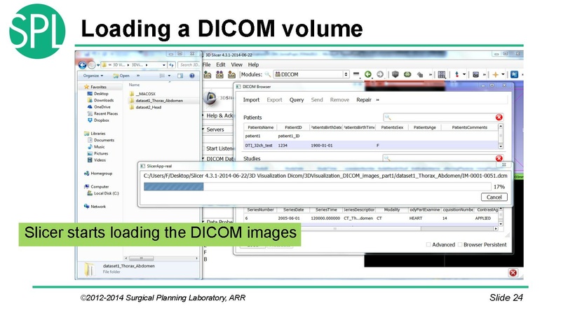 File:3DVisualizationDICOM SoniaPujol.pdf