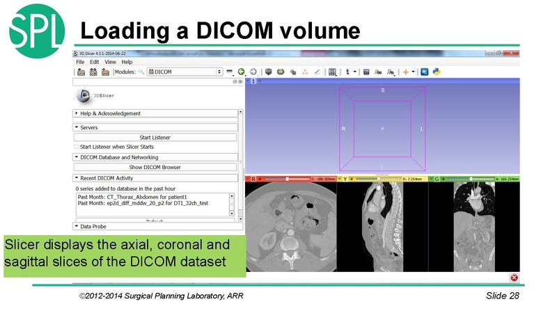 File:3DVisualizationDICOM SoniaPujol.pdf