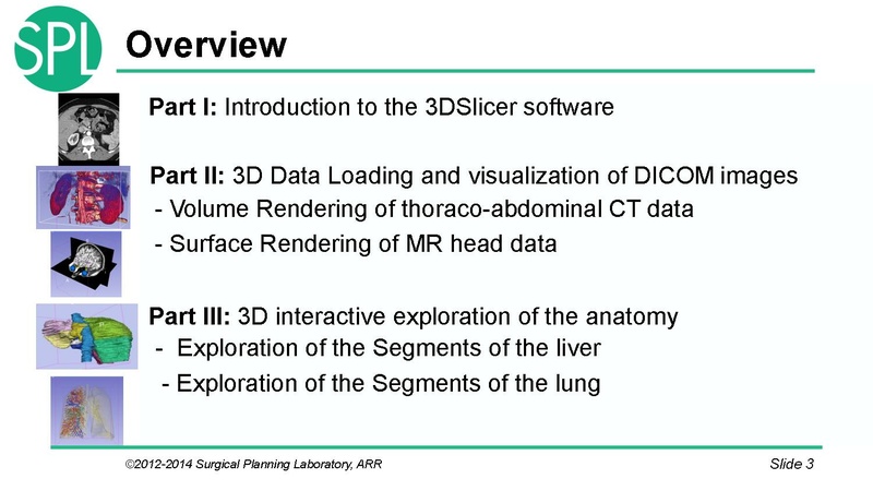 File:3DVisualizationDICOM SoniaPujol.pdf