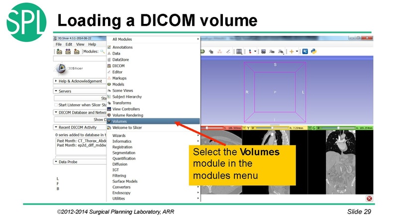 File:3DVisualizationDICOM SoniaPujol.pdf