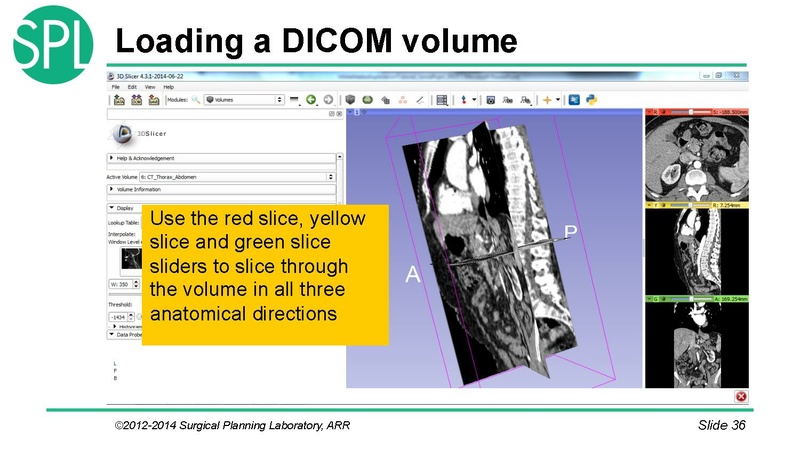 File:3DVisualizationDICOM SoniaPujol.pdf