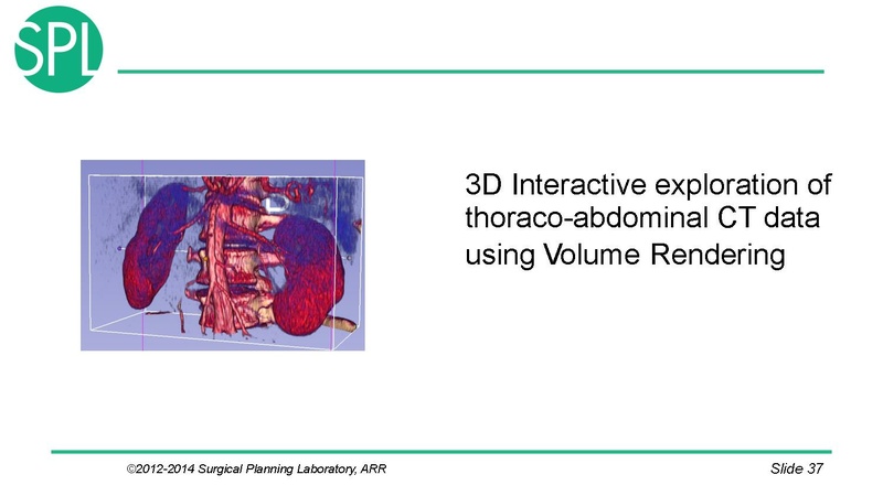 File:3DVisualizationDICOM SoniaPujol.pdf