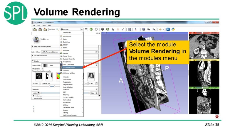 File:3DVisualizationDICOM SoniaPujol.pdf