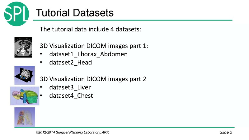 File:3DVisualizationDICOM SoniaPujol.pdf