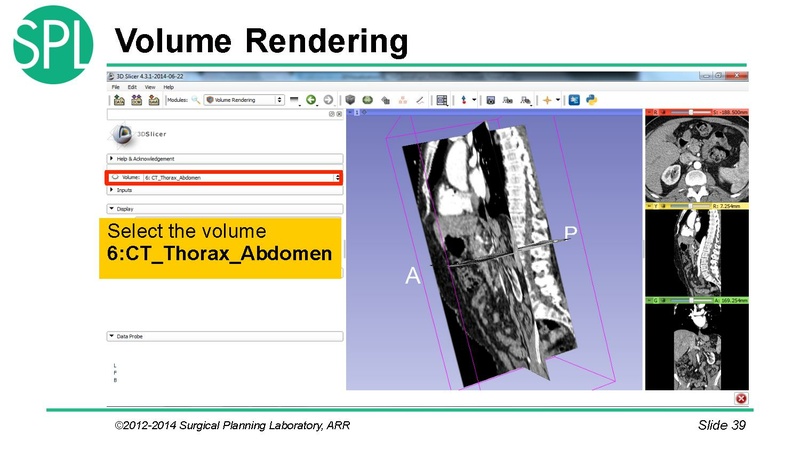 File:3DVisualizationDICOM SoniaPujol.pdf