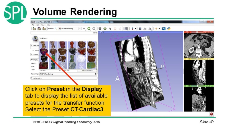File:3DVisualizationDICOM SoniaPujol.pdf