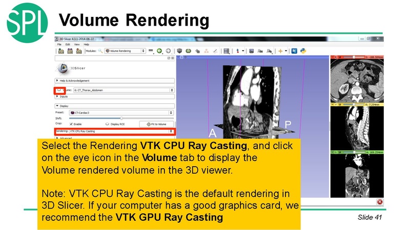File:3DVisualizationDICOM SoniaPujol.pdf