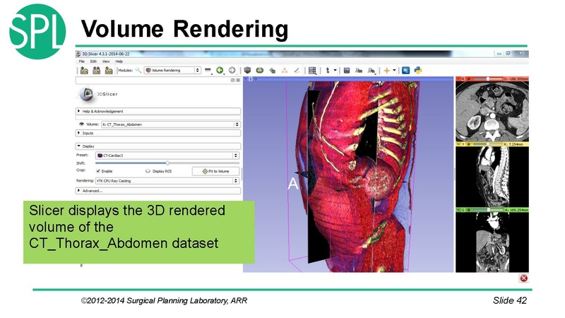 File:3DVisualizationDICOM SoniaPujol.pdf
