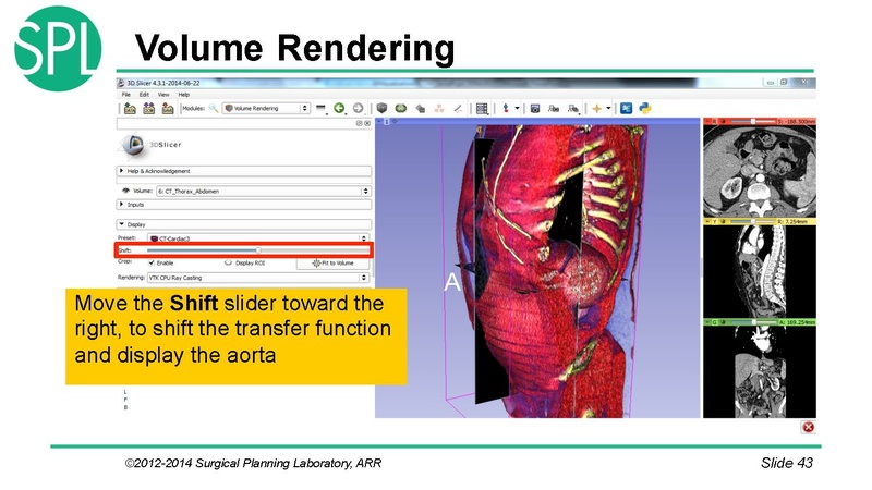 File:3DVisualizationDICOM SoniaPujol.pdf