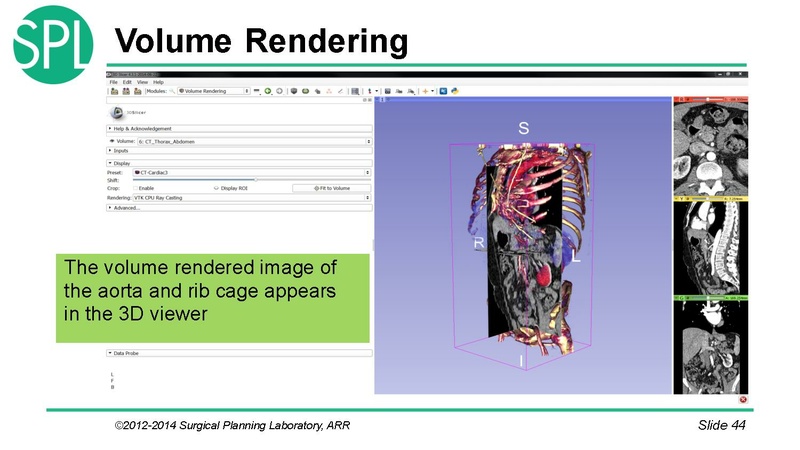 File:3DVisualizationDICOM SoniaPujol.pdf