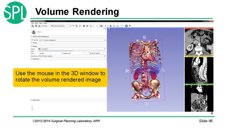 File:3DVisualizationDICOM SoniaPujol.pdf