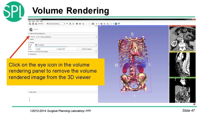 File:3DVisualizationDICOM SoniaPujol.pdf