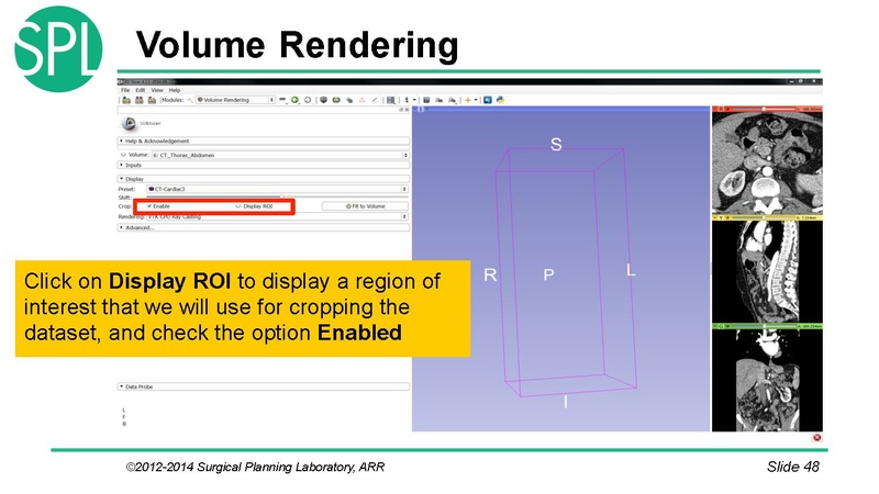 File:3DVisualizationDICOM SoniaPujol.pdf