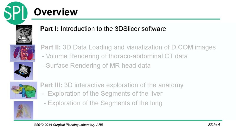 File:3DVisualizationDICOM SoniaPujol.pdf