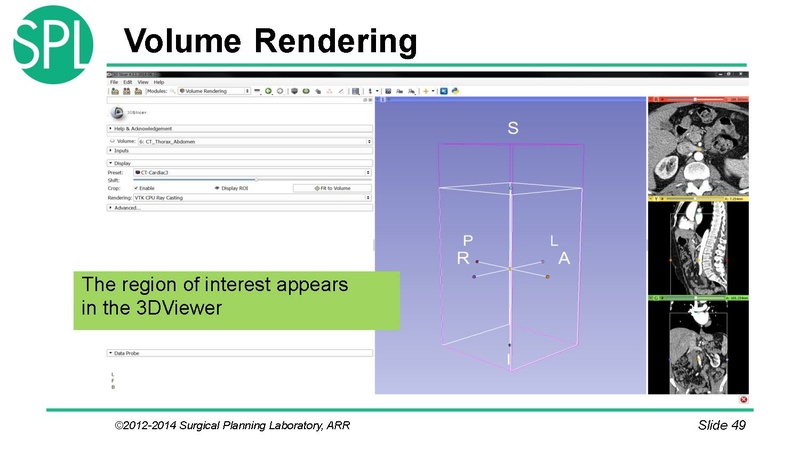 File:3DVisualizationDICOM SoniaPujol.pdf