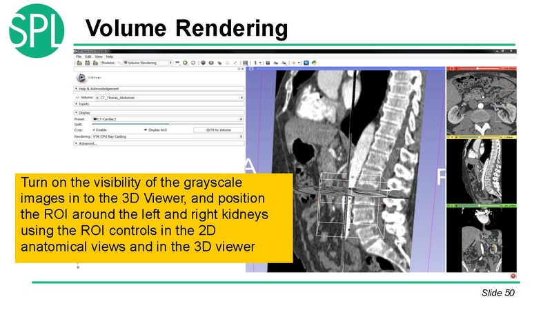File:3DVisualizationDICOM SoniaPujol.pdf