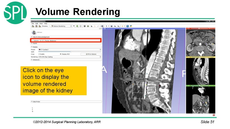 File:3DVisualizationDICOM SoniaPujol.pdf