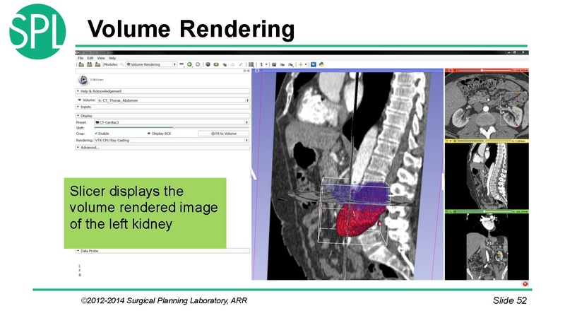 File:3DVisualizationDICOM SoniaPujol.pdf