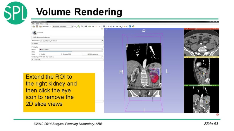 File:3DVisualizationDICOM SoniaPujol.pdf