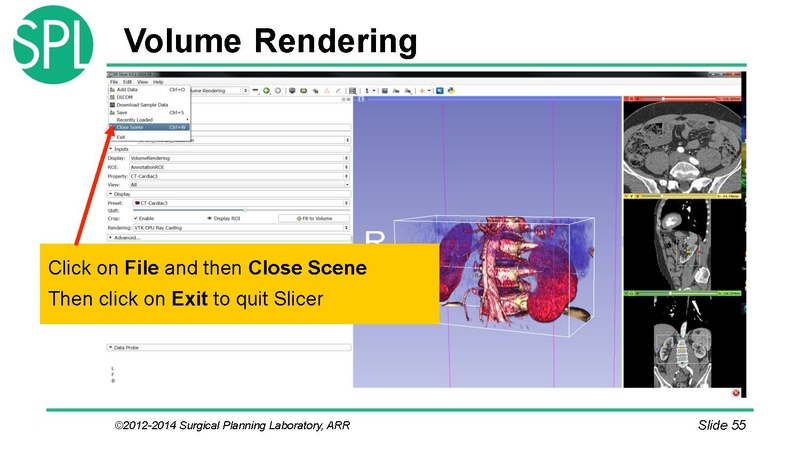 File:3DVisualizationDICOM SoniaPujol.pdf