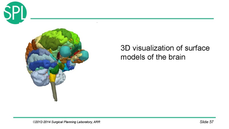 File:3DVisualizationDICOM SoniaPujol.pdf