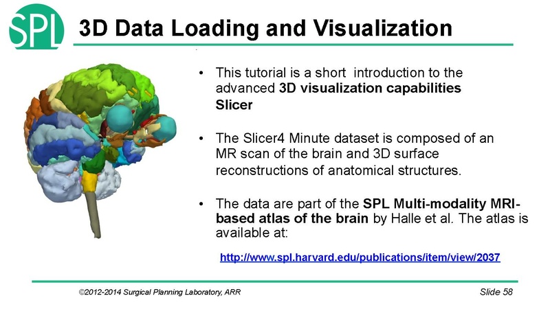 File:3DVisualizationDICOM SoniaPujol.pdf