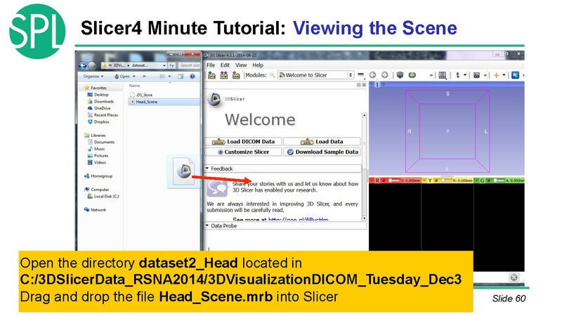 File:3DVisualizationDICOM SoniaPujol.pdf