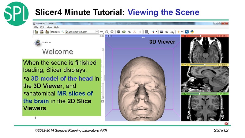 File:3DVisualizationDICOM SoniaPujol.pdf