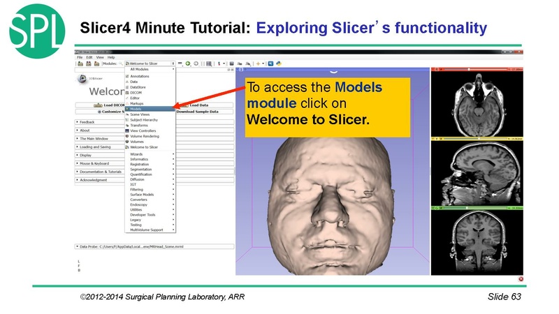 File:3DVisualizationDICOM SoniaPujol.pdf