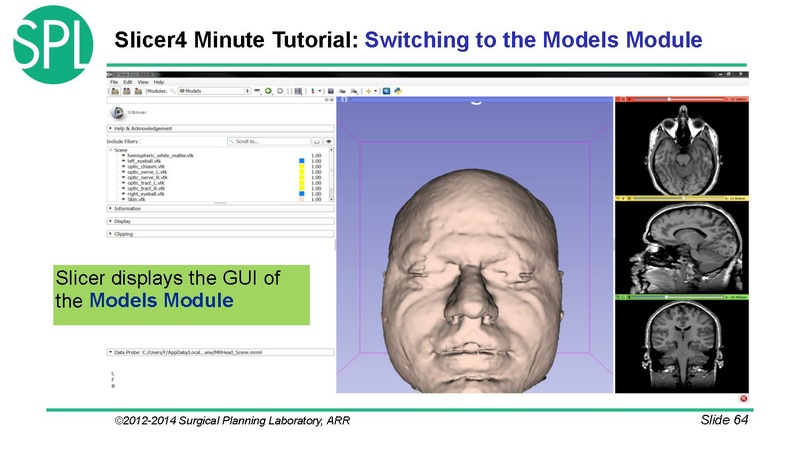 File:3DVisualizationDICOM SoniaPujol.pdf