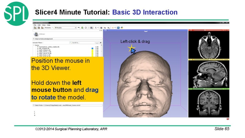 File:3DVisualizationDICOM SoniaPujol.pdf