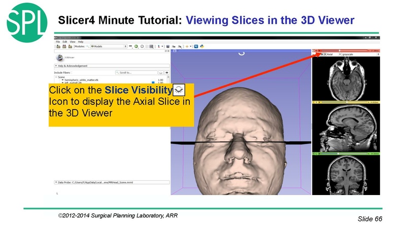 File:3DVisualizationDICOM SoniaPujol.pdf