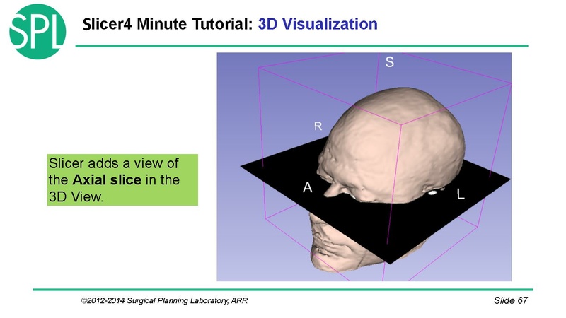 File:3DVisualizationDICOM SoniaPujol.pdf