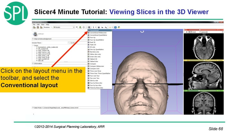 File:3DVisualizationDICOM SoniaPujol.pdf