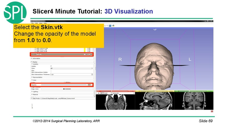 File:3DVisualizationDICOM SoniaPujol.pdf