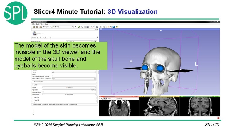 File:3DVisualizationDICOM SoniaPujol.pdf