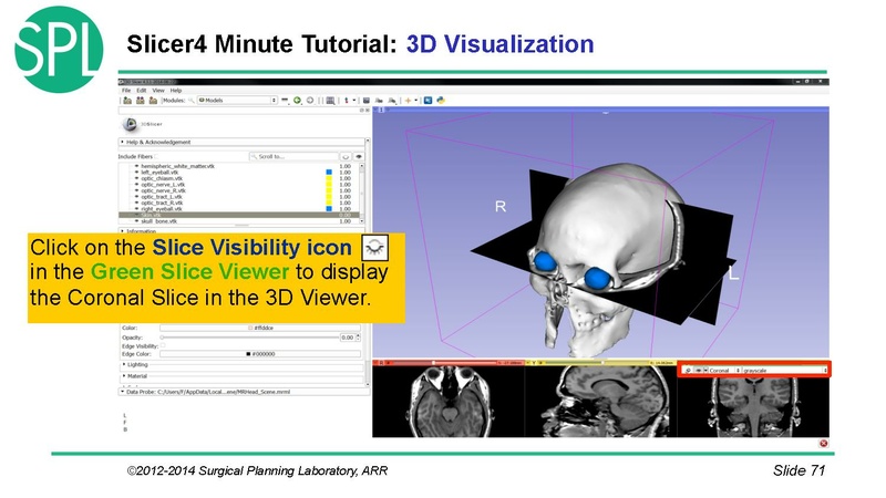 File:3DVisualizationDICOM SoniaPujol.pdf