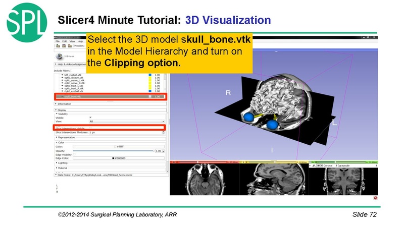 File:3DVisualizationDICOM SoniaPujol.pdf